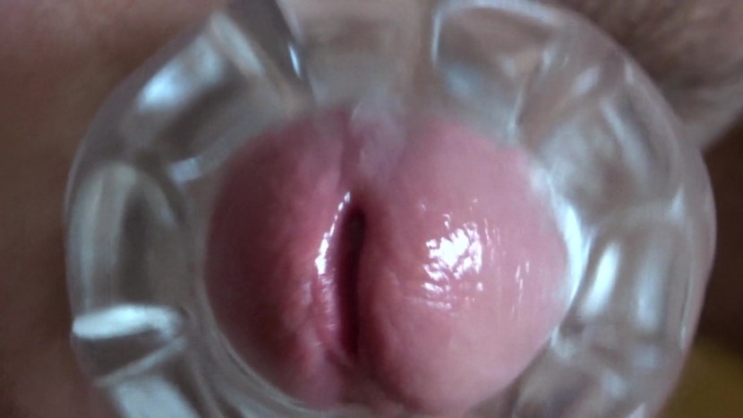 Huge female clitoris ends