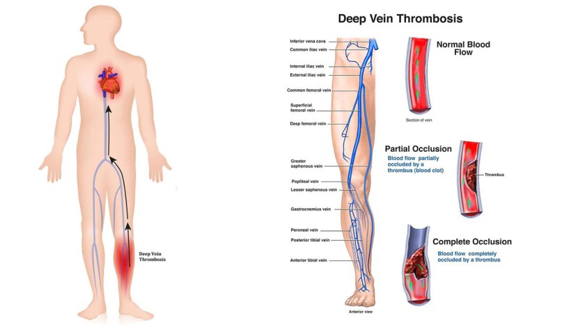 Finger on the right hand of heat
