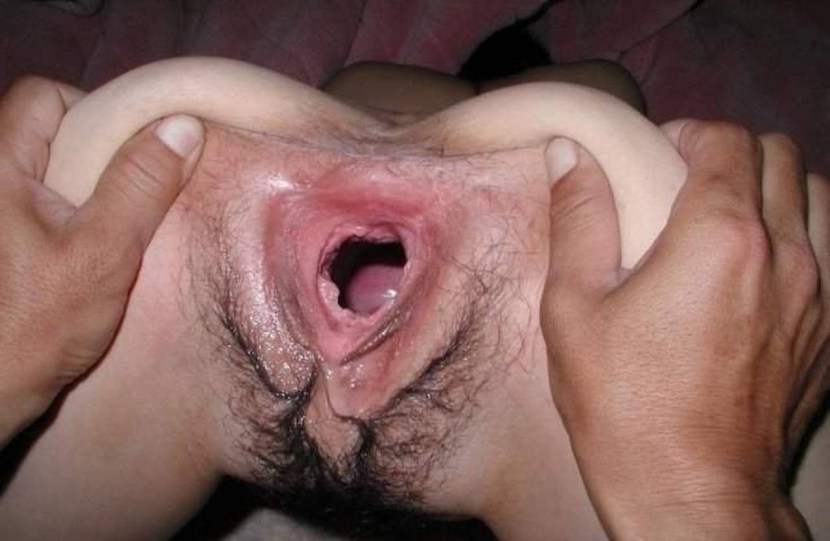 Women with large vagina