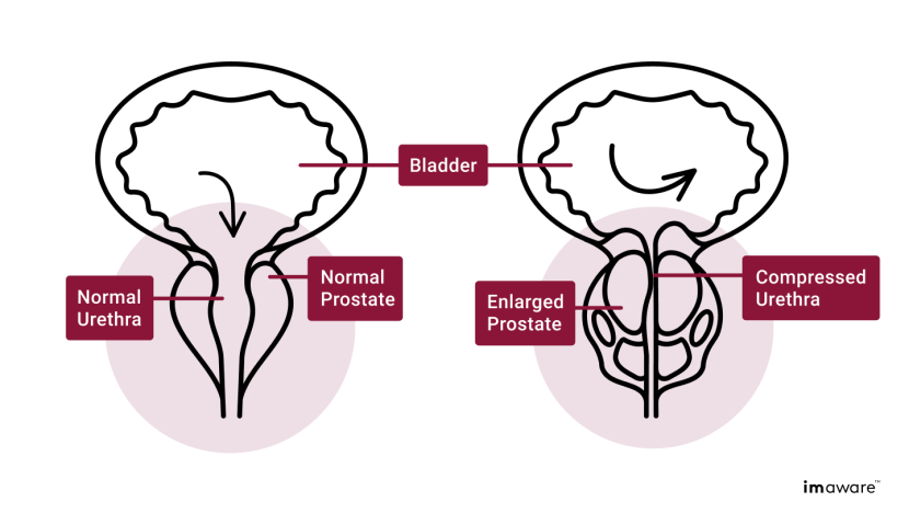Keto diet table products