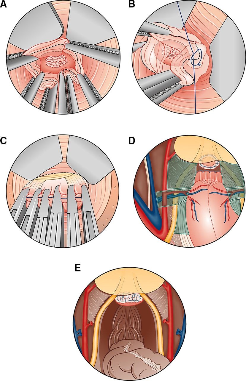 Varieties of virgin rods