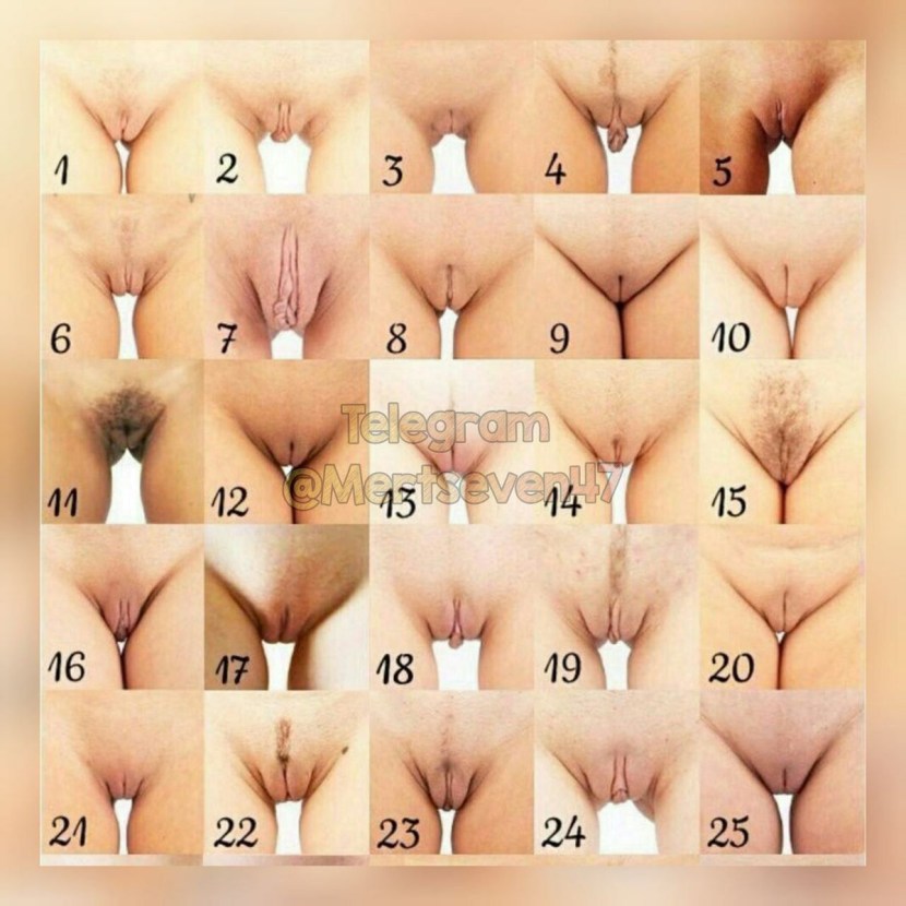 Varieties of women's vagina