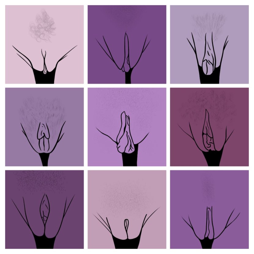 Non -standard vagina