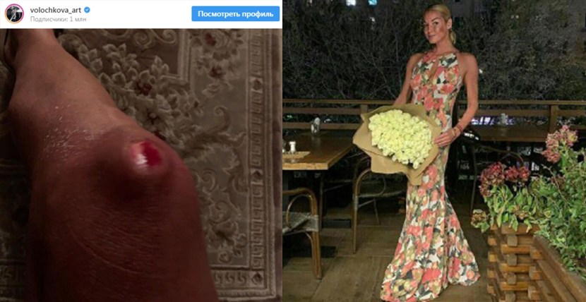 Naked women close -up