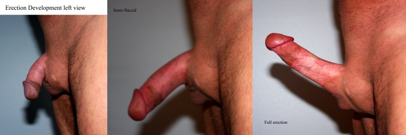 Male member without erection