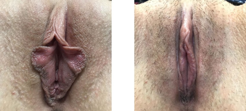 Porn actress Anal Big Pussy Lips