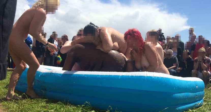 Naked nudist with a scar from appendicitis