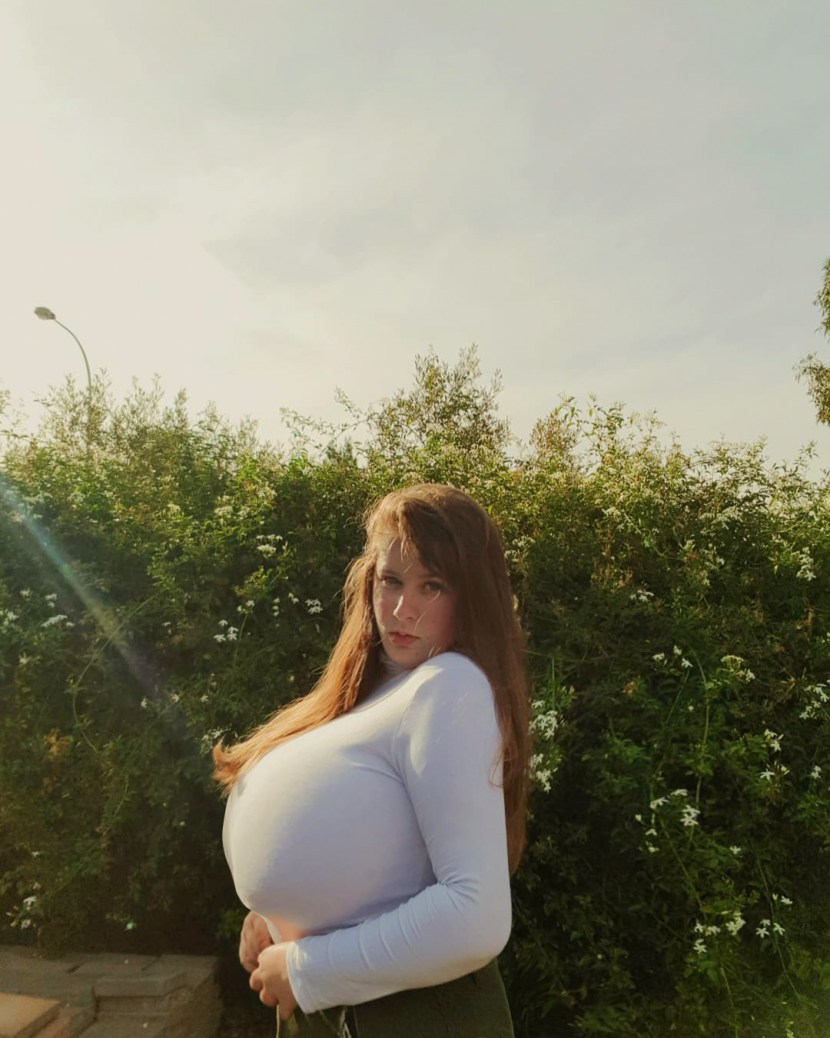 Svetlana Romanova Macromastia