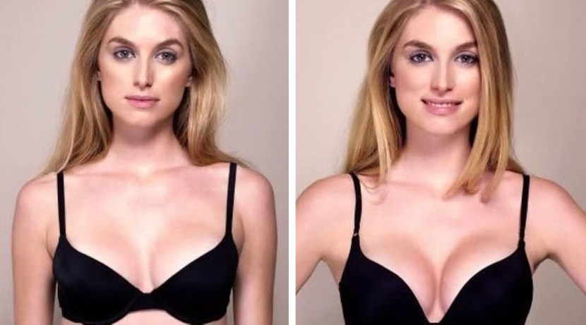 Pushap before and after