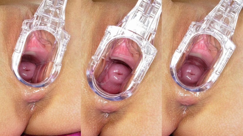 Vaginal expander inside