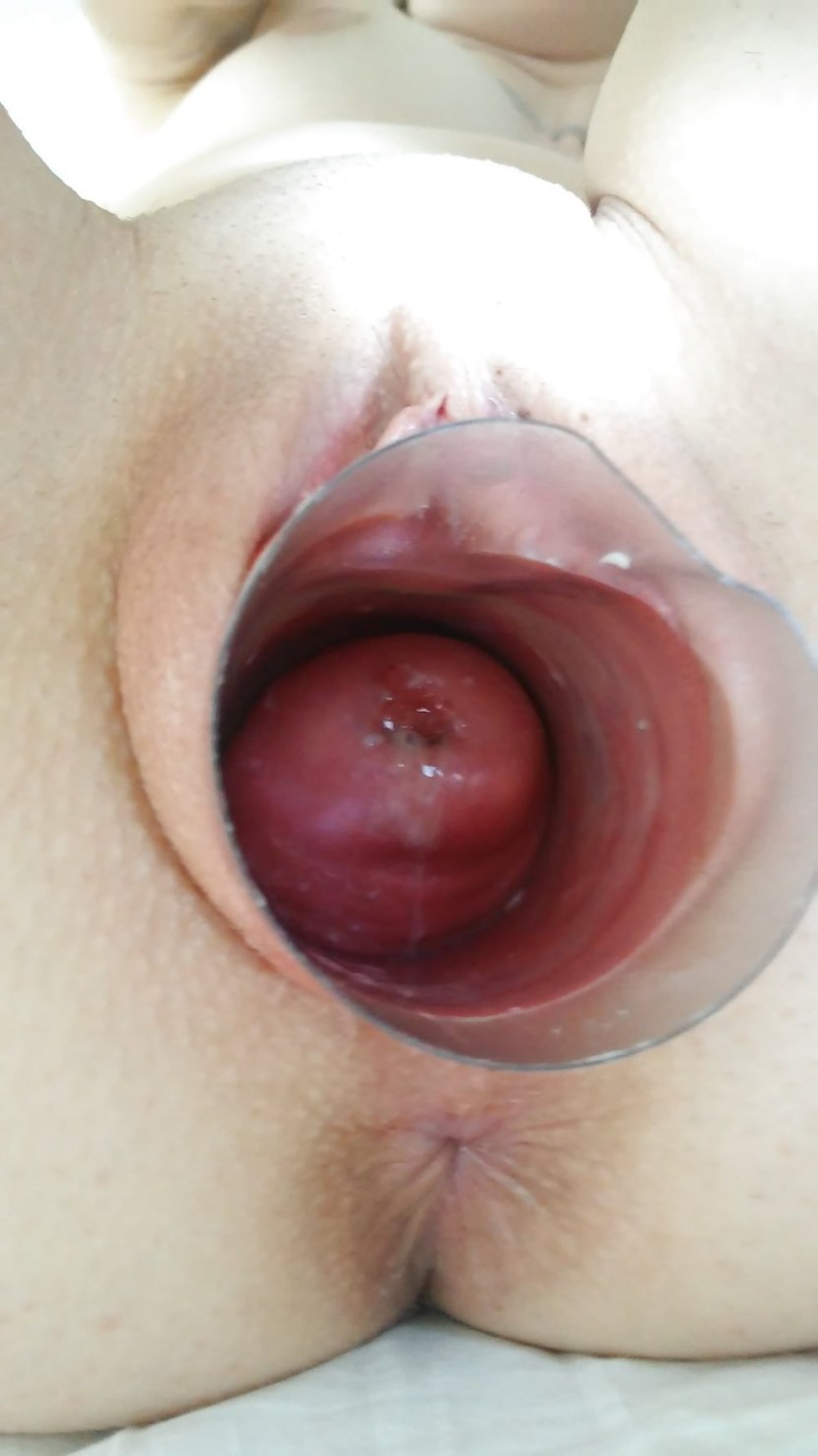 Mature with the vaginal expander