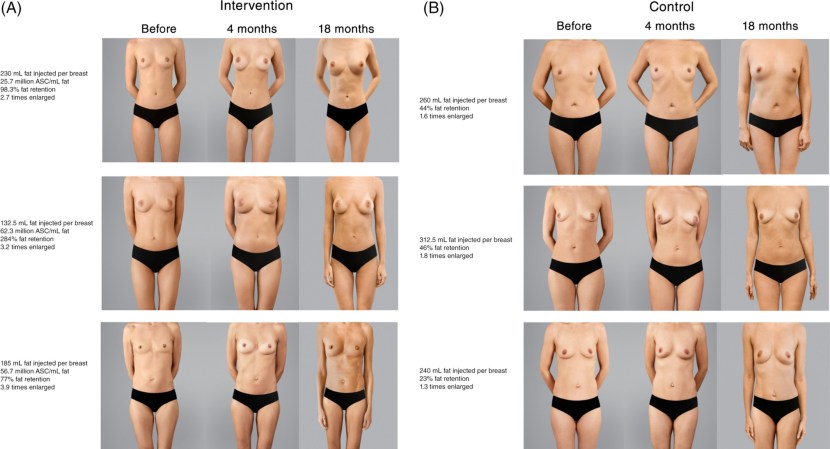 PCR Coronavirus Test