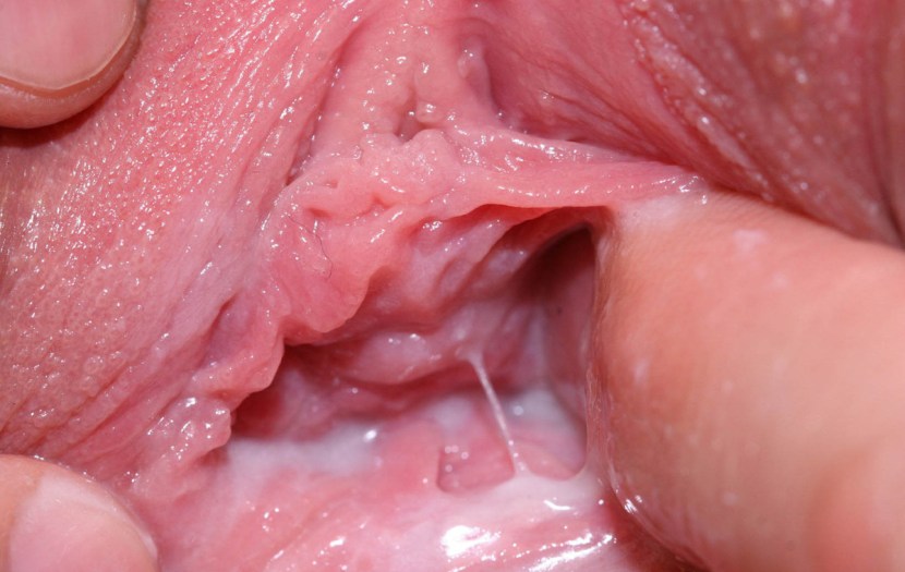 The insides of the vagina