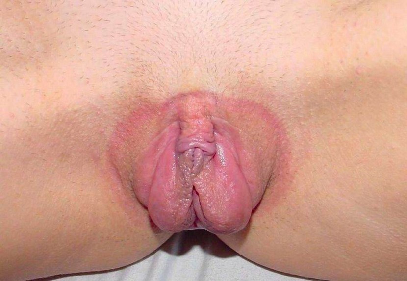 Unusually beautiful vulva