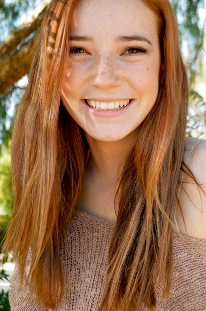 The girl's crooked teeth are beautiful with freckles