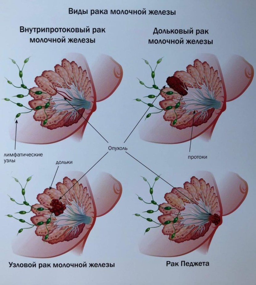 Bill Murray in her father