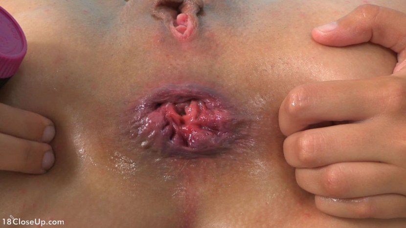 Orgasm reduction of the anus