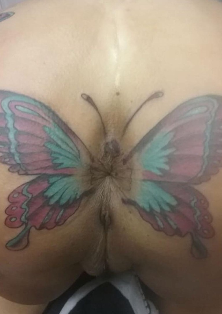 Girl with a butterfly tattoo on her eye socket