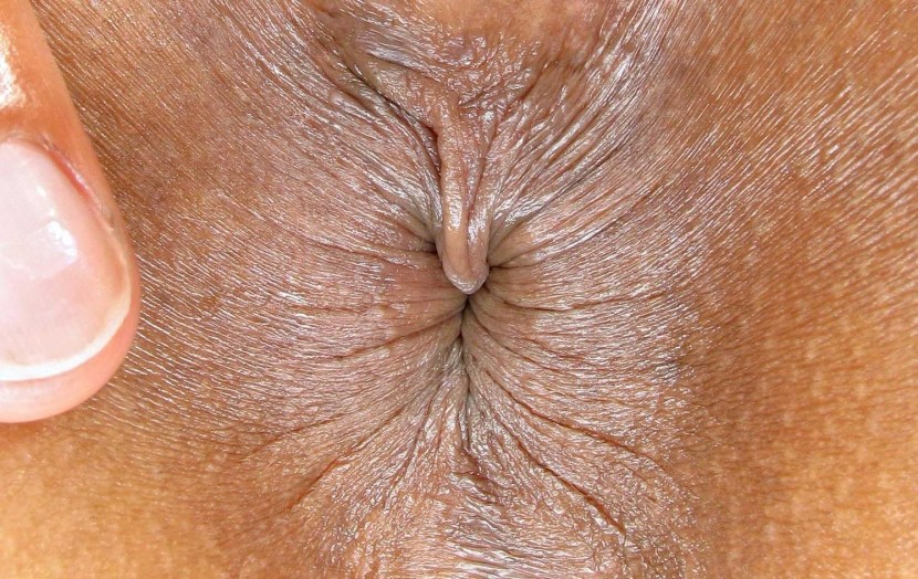 Brown anus is large