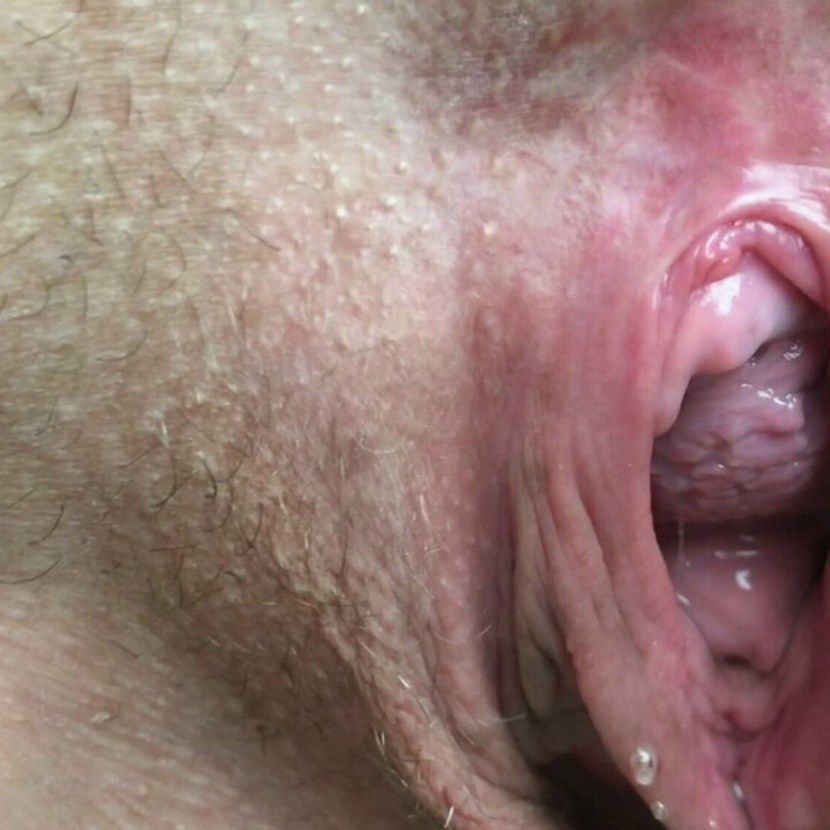 Old vagina close -up