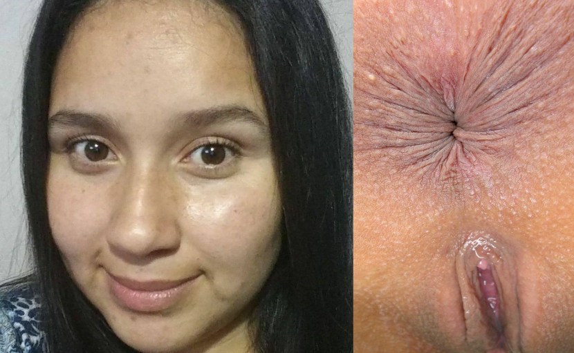 Anus smooth girls do i posle