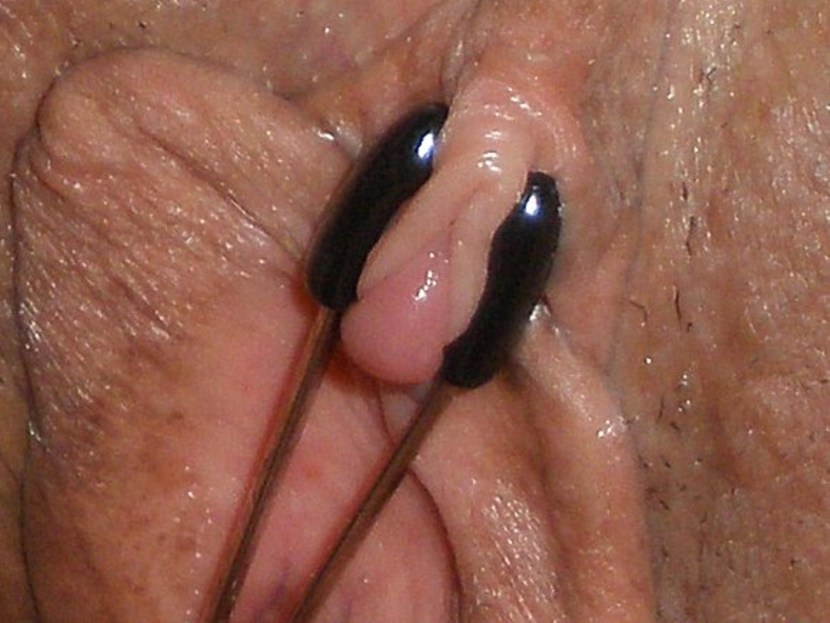 Insects on women's genitals