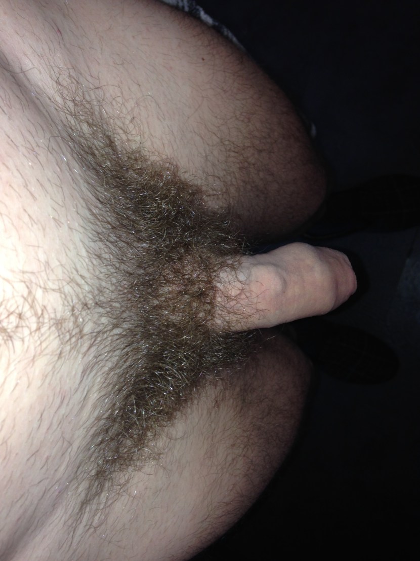 Hairy -rash underlying underpants