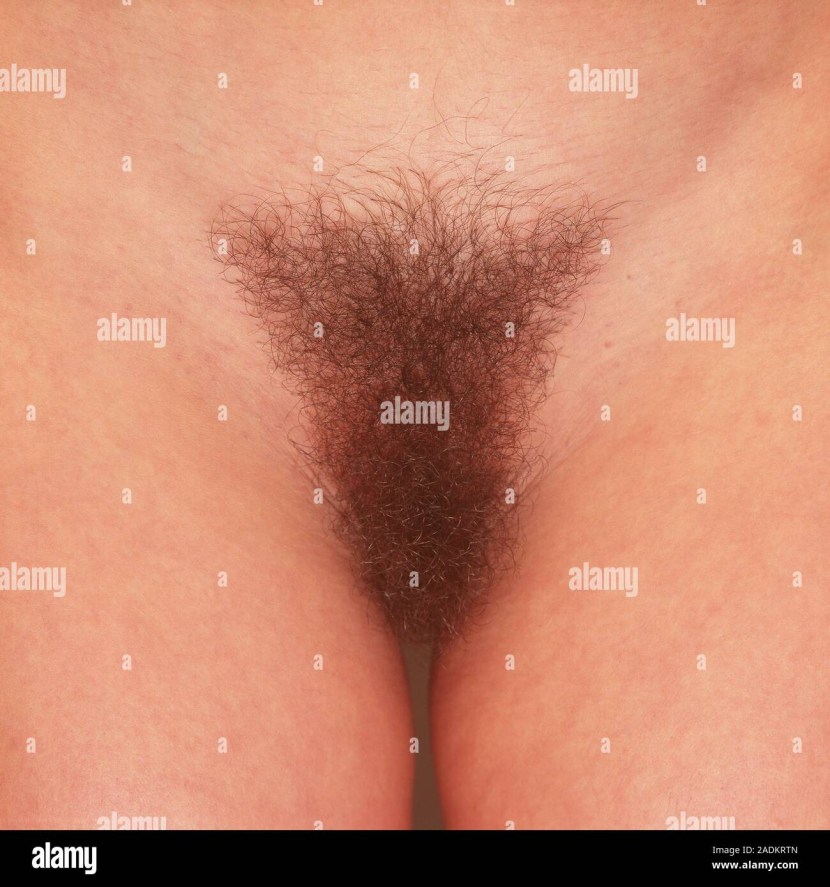 Pubic hair in women