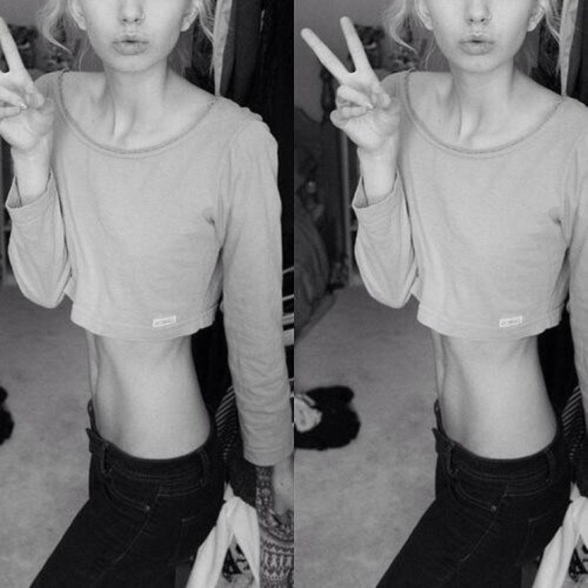 Tatyana Romanova Anorexia