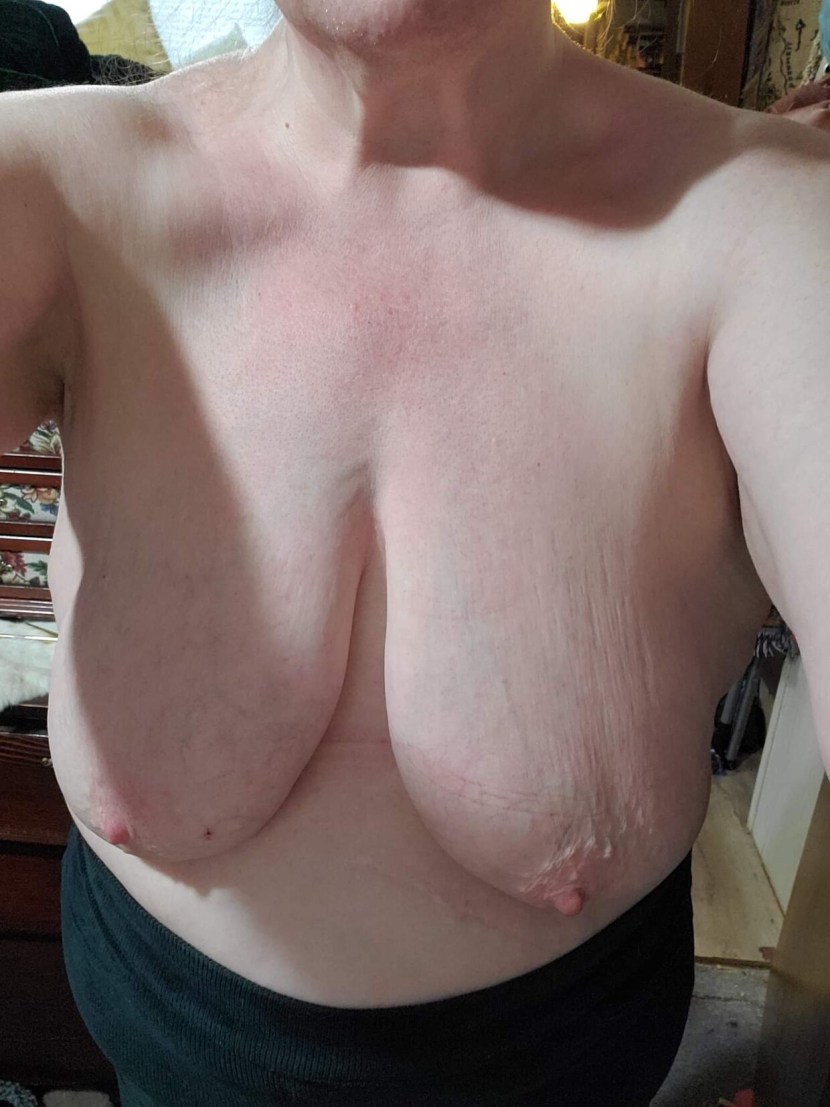 Skinny Saggy Breast Nipples Sex