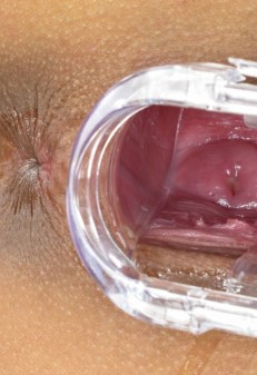 Porn with A Camera in the Uterus (69 photos)