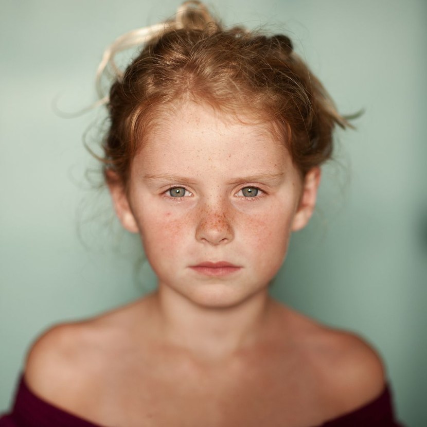 Brown freak on the face of a child