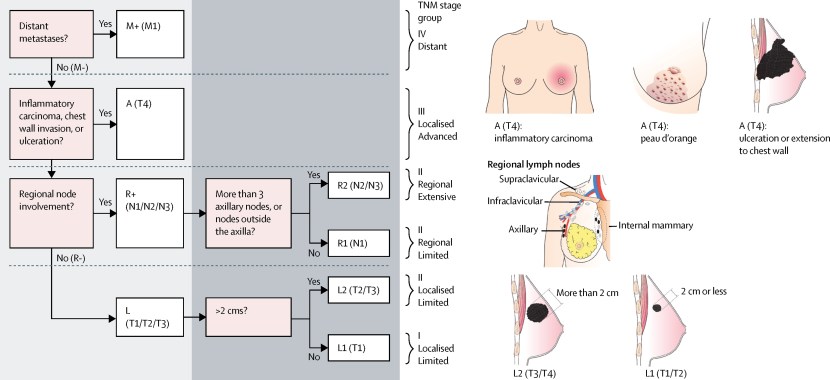 Carmen Corporation Lobotomy