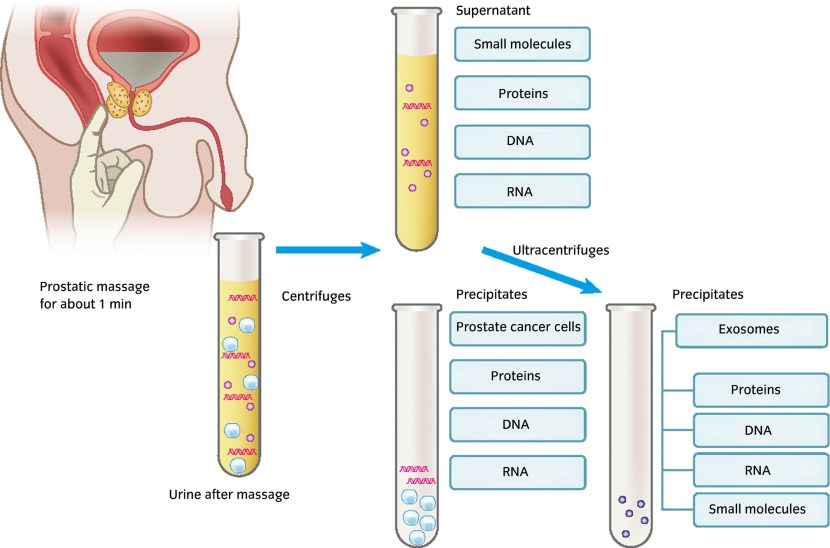Angela Lobotomy Corporation
