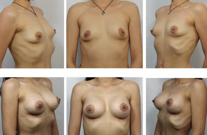 Naked women of different complexes