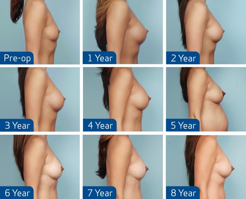 Naked women of average fatness
