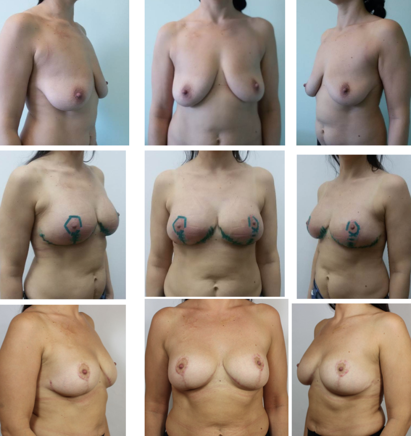Naked chest of all sizes