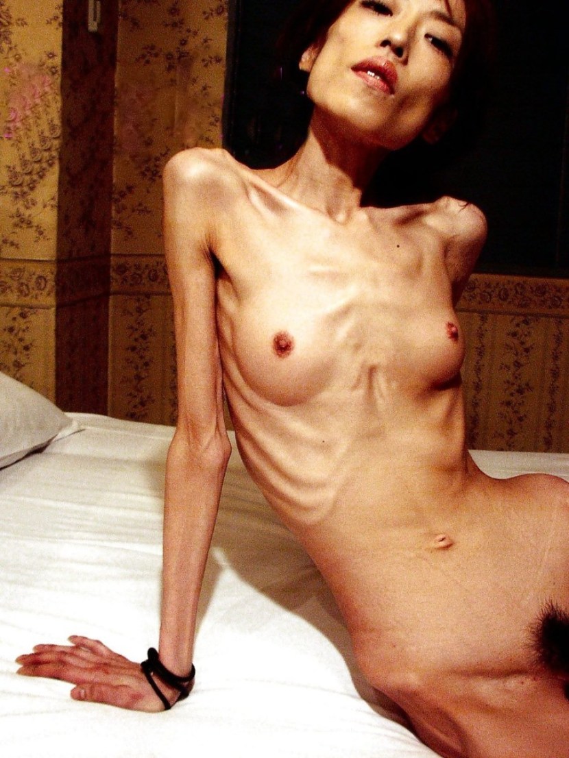Naked anorexic women