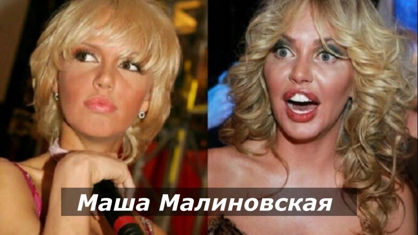 Malinovskaya Masha before operations