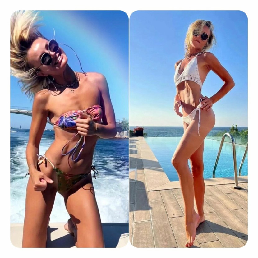 Polina Gagarina Anorexia 2022