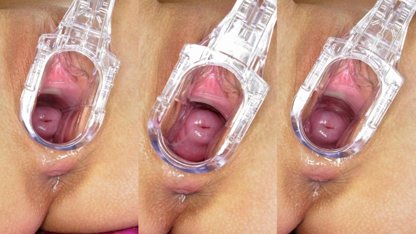 Vaginal expander inside