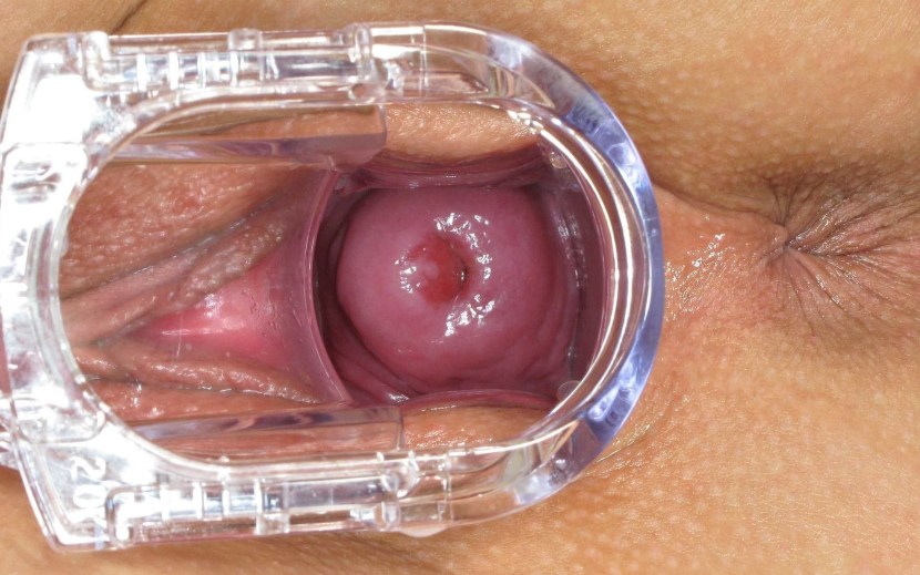 Healthy vagina from the inside