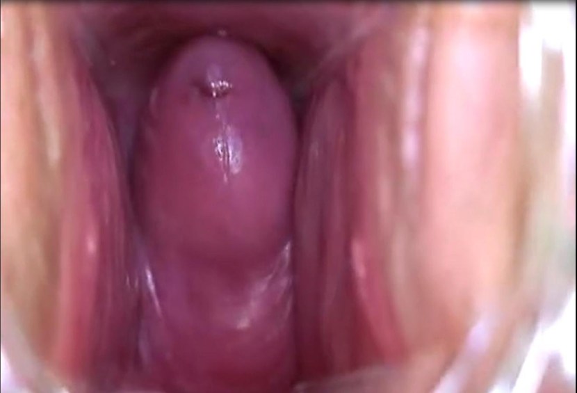 Women's vagina from the inside