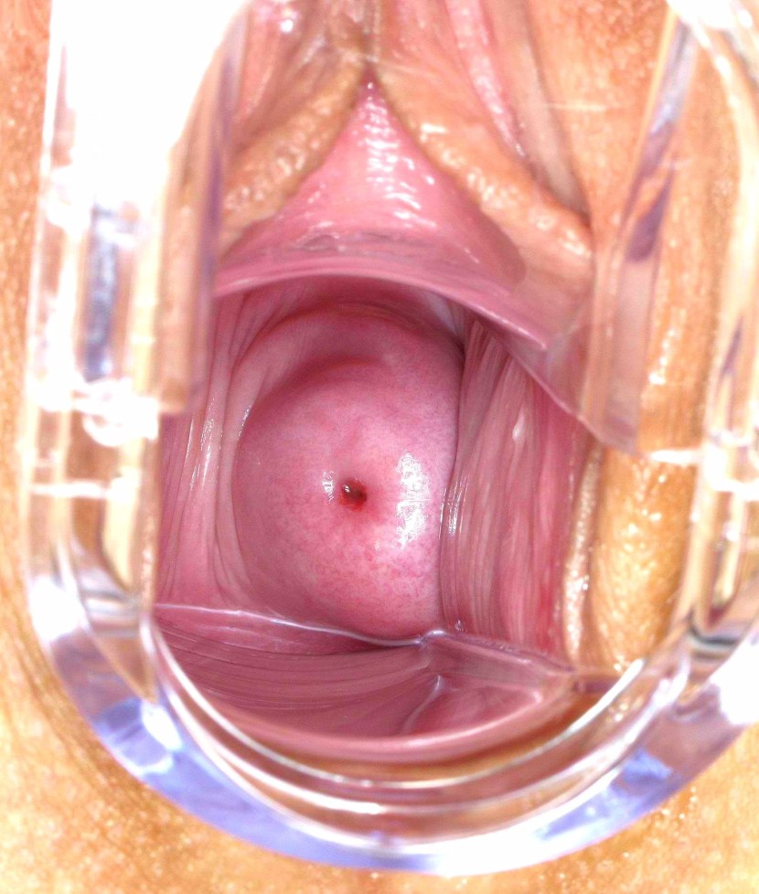 Women's vagina from the inside