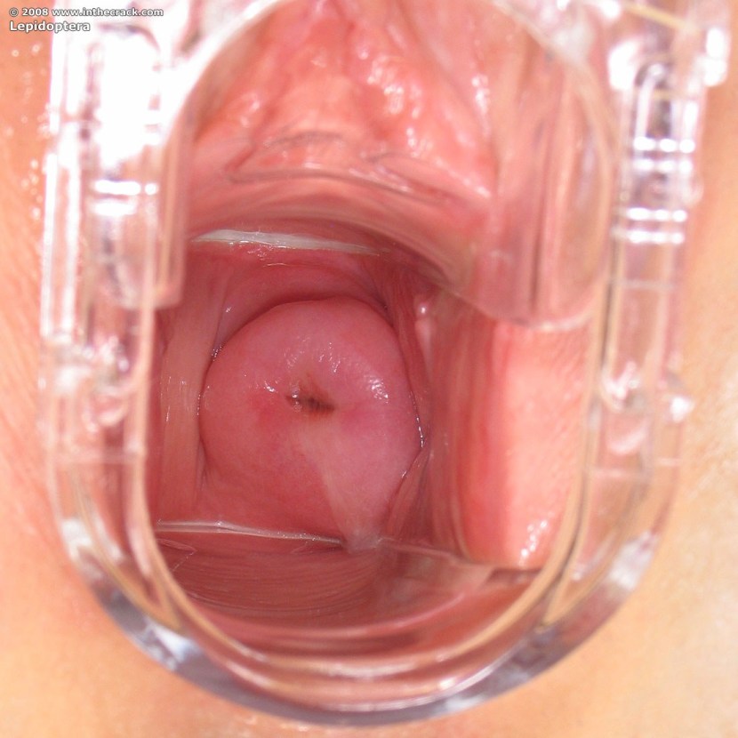 Healthy vagina inside