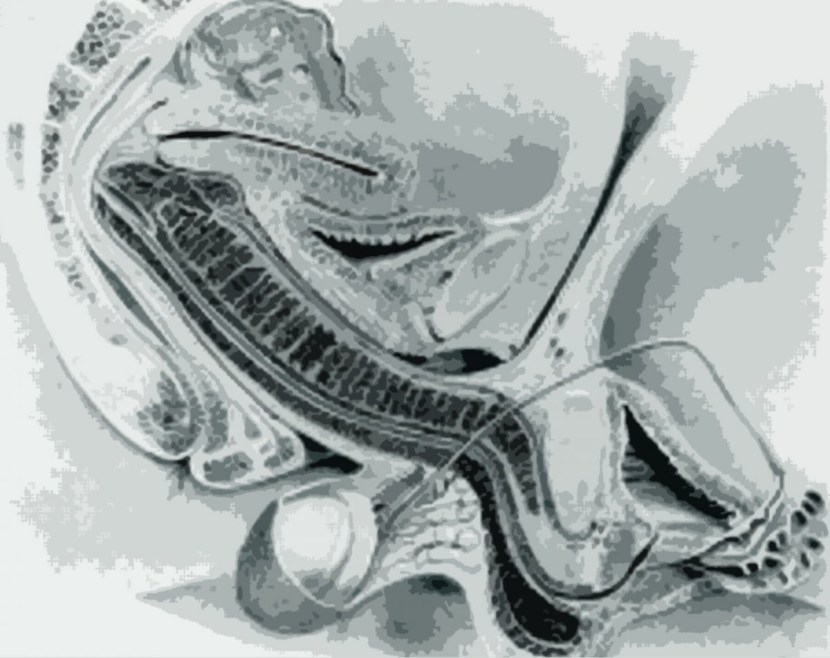 The walls of the vagina from the inside