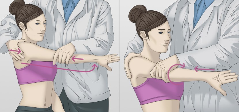 Bilateral orchiectomy