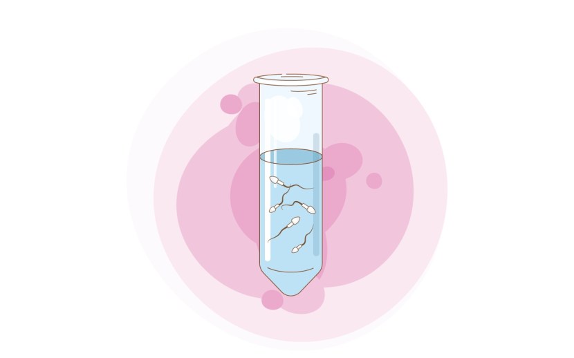 Extracorporeal fertilization drawing