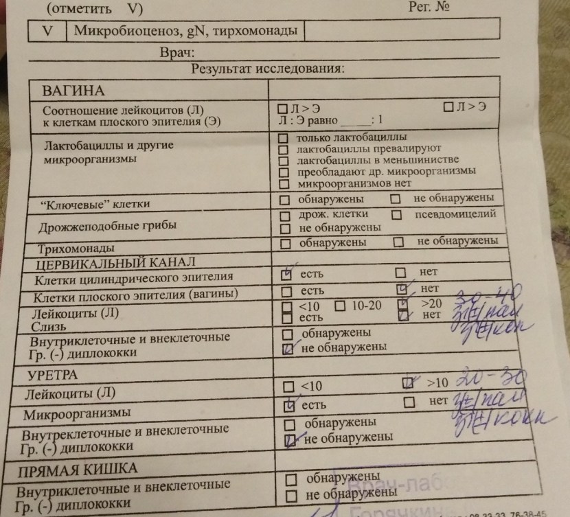 Micoscopic examination smear norm of leukocytes