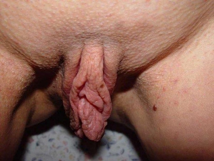 Huge clitoris and labia